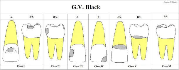 GV-BLACK-1